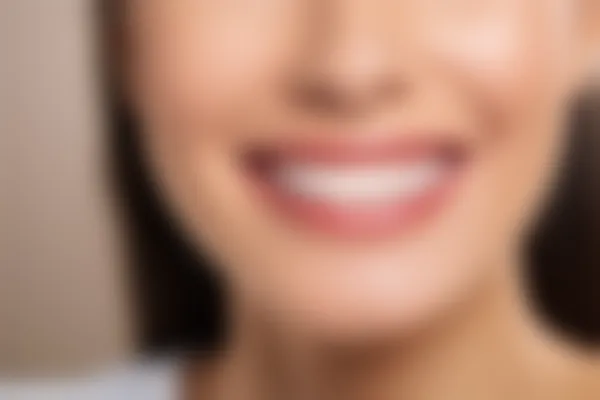 如何正确佩戴地包天矫正器？详细步骤与注意事项解析