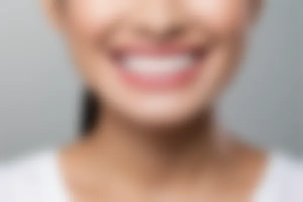树脂补牙的耐久性如何？补牙后容易掉落吗？