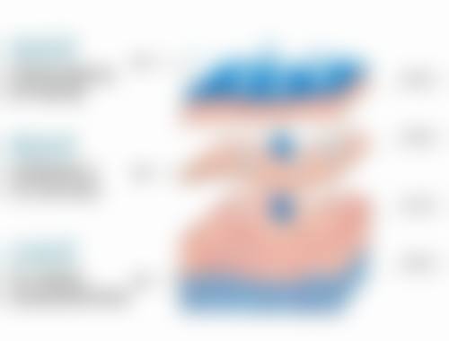 北京米兰柏羽丽都医院：淡化色素型黑眼圈套餐，嗨体熊猫+欧洲之星眼周，原价4880元，现4800元再享50元补贴！ 