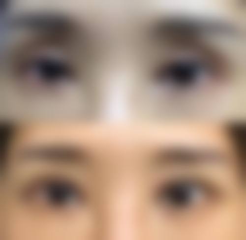 韩国伍人整形外科怎么样医生团队实力