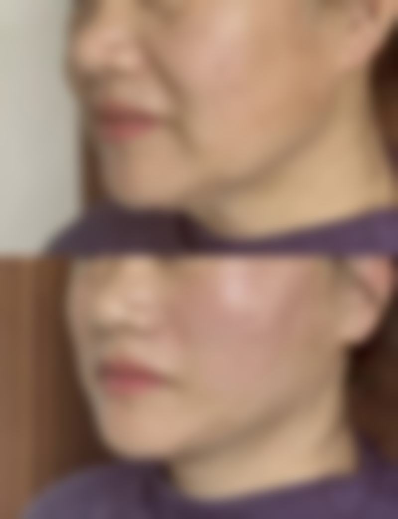 贺州市皮肤病防治院怎么样价格收费