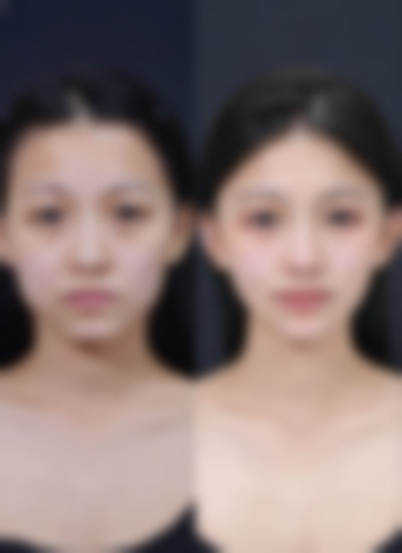 魏圣润院长的特色技术与显著成效