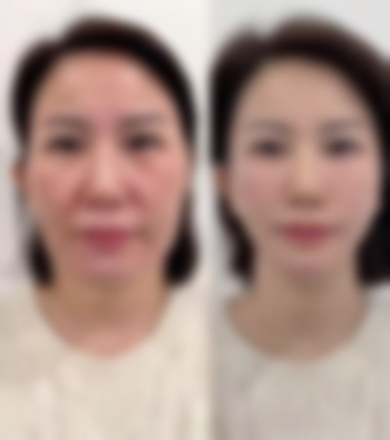 太原臻妍医疗美容诊所怎么样价格收费