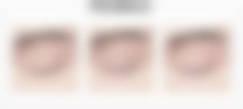 魏圣润院长的成功实例