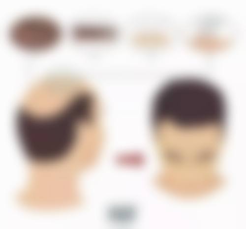 李挺医生助力下的特色技术项目