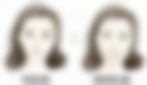 snow牙科怎么样来院路线