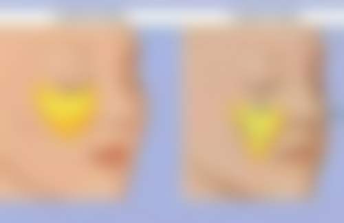 宁波珈禾整形专科医院