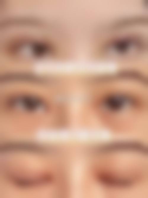 朴永佑医生的技术特色