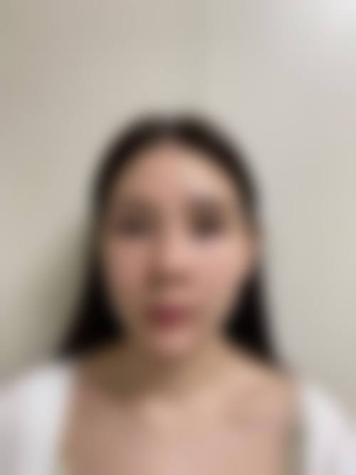 兰州莱尚医疗美容门诊部怎么样特色项目及技术优势