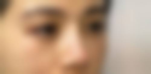 南宁市第二人民医院(烧伤整形外科)怎么样来院路线