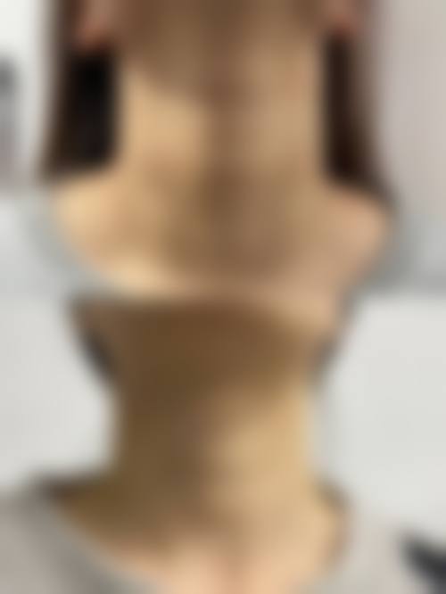 内江柒亿洋子医疗美容诊所怎么样求美者反馈