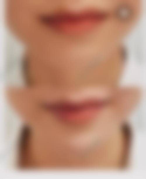 郑承镐医生的就诊价格与询问方式