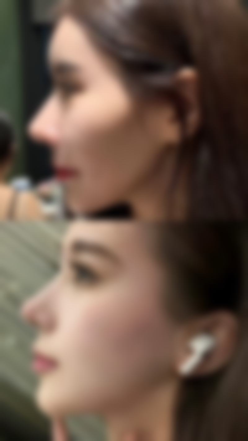 福州优医联合医疗美容诊所怎么样价格收费