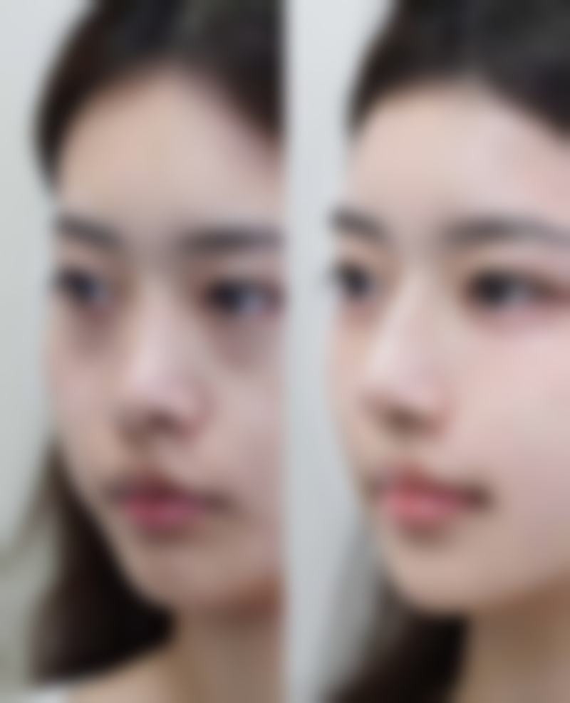 张家界瑞美整形医院怎么样求美者反馈