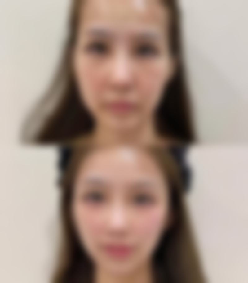 福州优医联合医疗美容诊所怎么样特色项目及技术优势