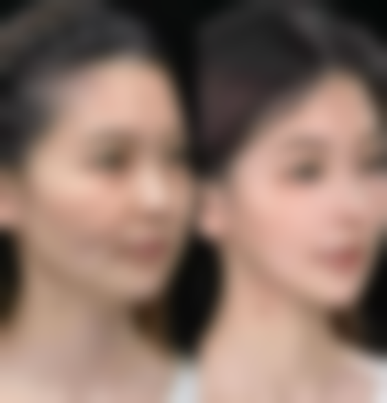 张家界瑞美整形医院怎么样价格收费