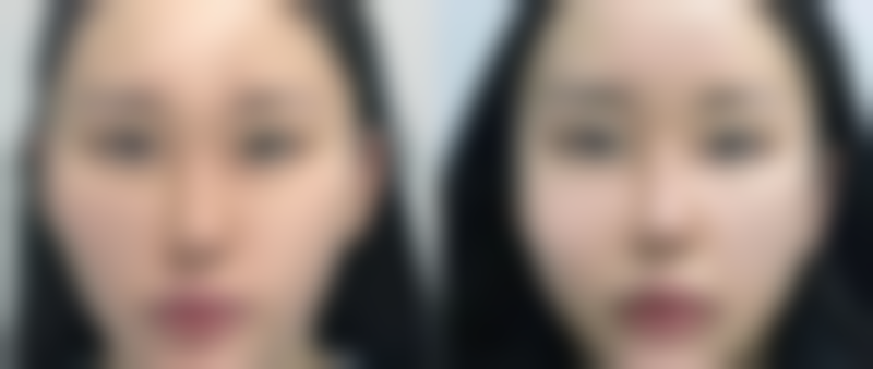 李柄旭医生助您开启美丽之旅