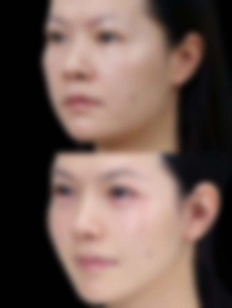 snow牙科怎么样求美者反馈