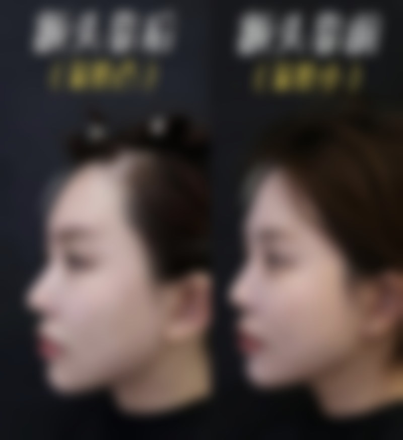 丽水慈爱医院整形美容中 心怎么样医生团队实力