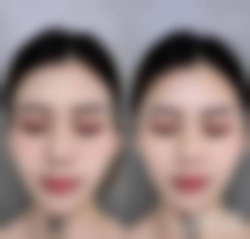 信赖郑承镐医生开启美丽之旅