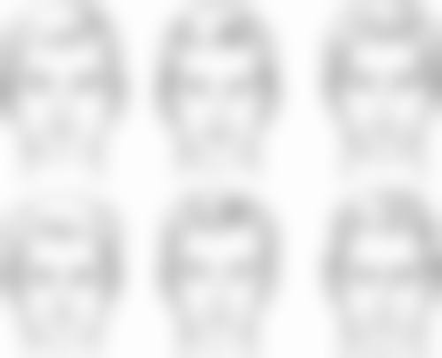 韩国半岛眼整形外科医院怎么样特色项目及技术优势