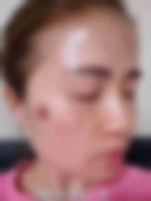 广州健康医然医疗美容门诊部怎么样求美者反馈