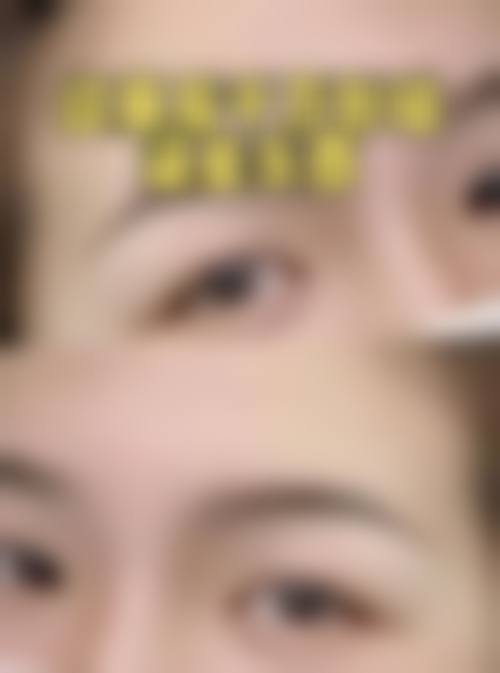 重庆巫山米格整形医院怎么样价格收费