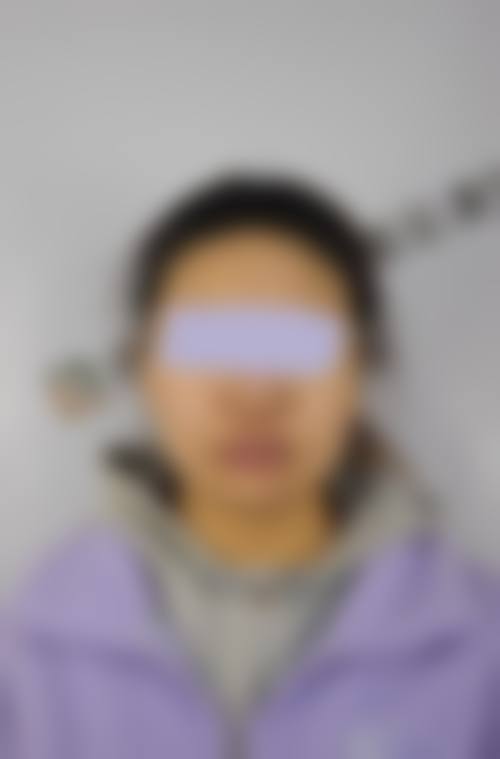 枣庄矿务局医院美容整形中 心怎么样求美者反馈