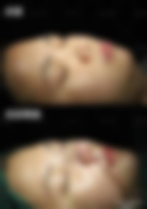 朴永佑的手术特色与优势