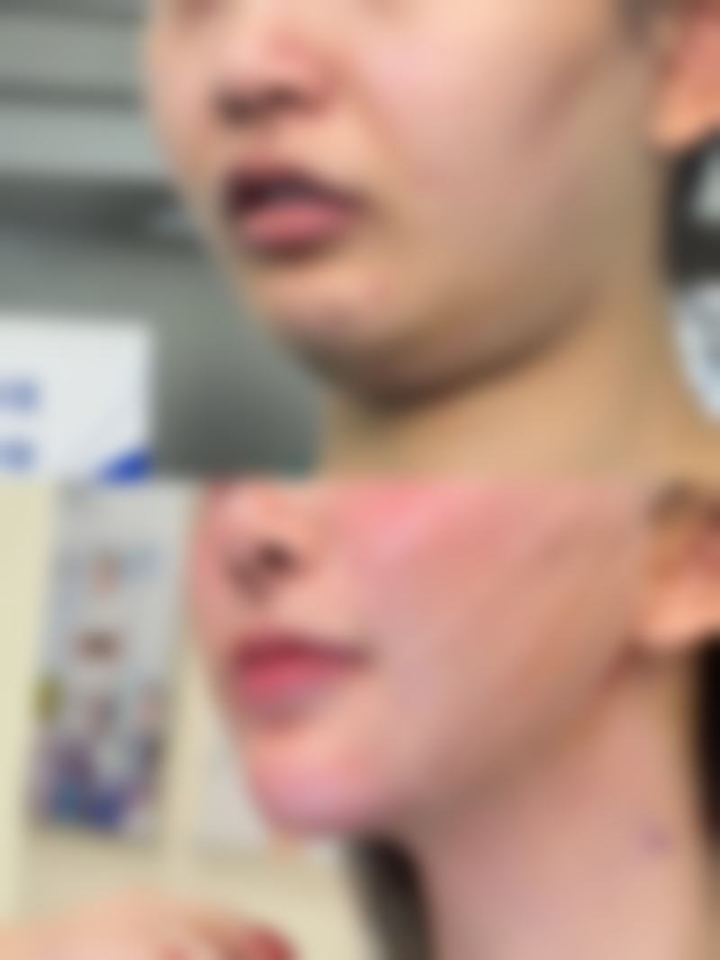 凯里易美医疗美容门诊部怎么样求美者反馈