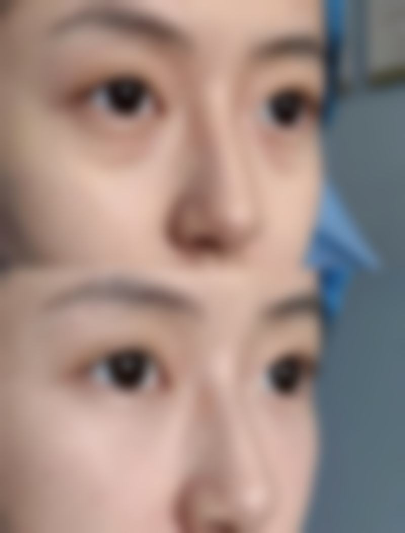 韩国半岛眼整形外科医院怎么样简介概述