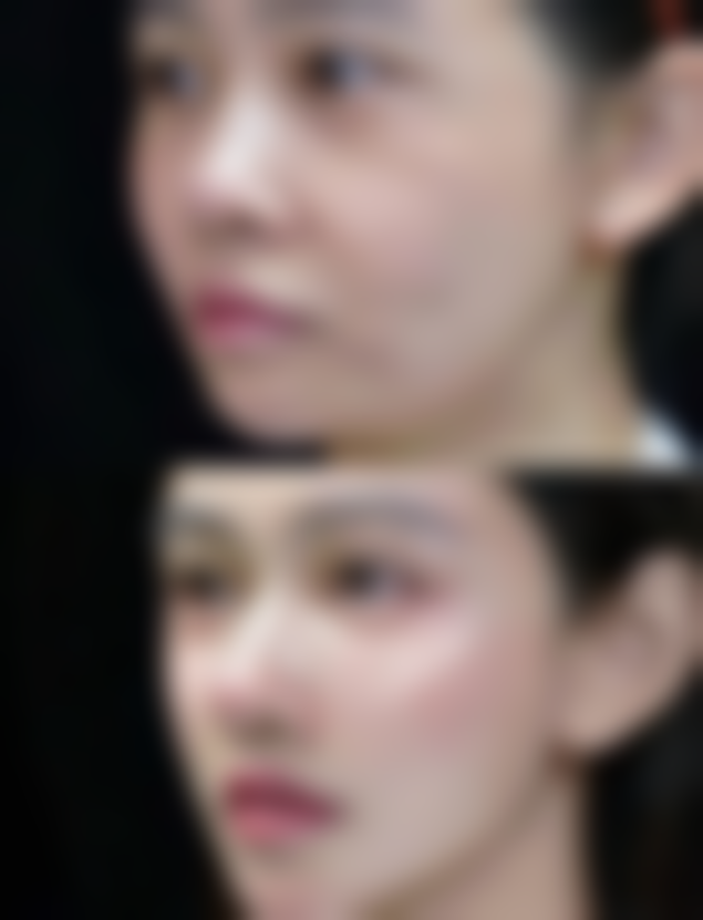 李柄旭医生的价格说明