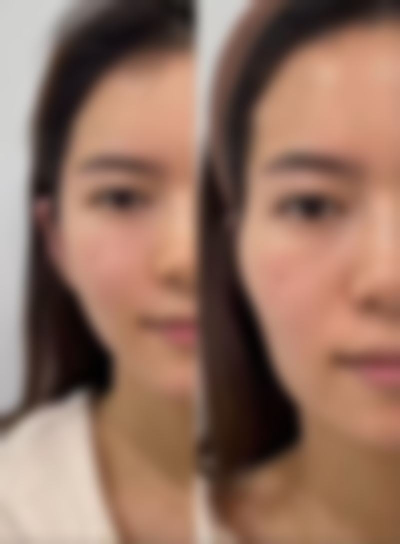 韩国半岛眼整形外科医院怎么样来院路线