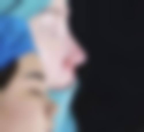 乌鲁木齐文艳医疗美容诊所怎么样价格收费