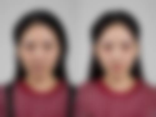 济南高新佳美医疗美容整形诊所怎么样特色项目及技术优势