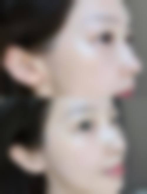 焦作解放梵荷医疗美容门诊部怎么样求美者反馈