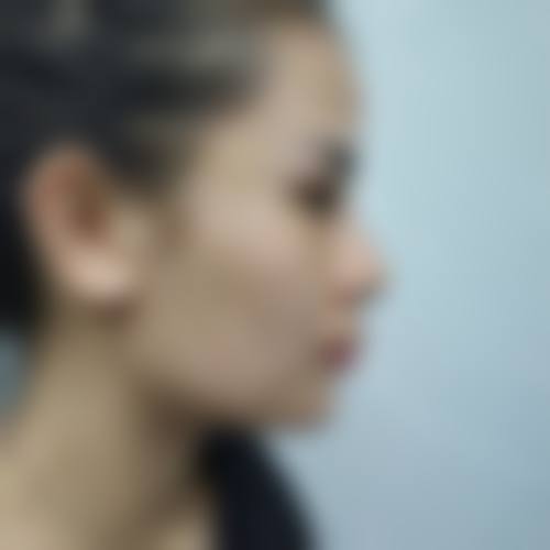 宁德东方秀丽华美整形医院怎么样求美者反馈