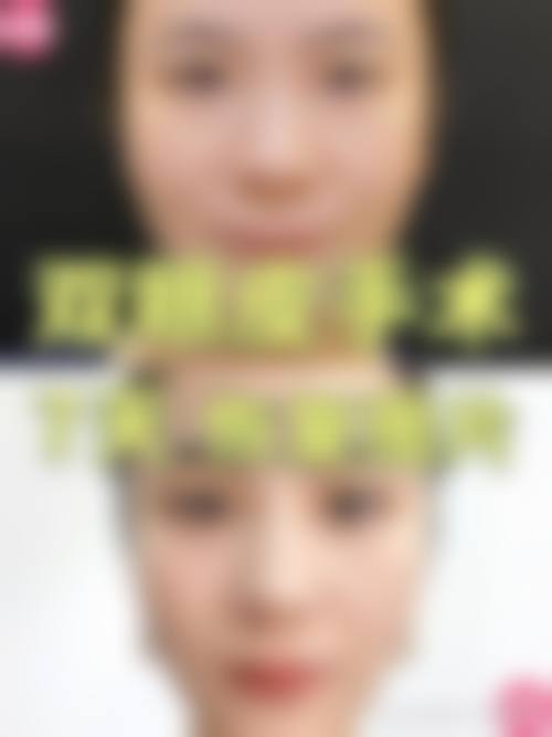 重庆三峡中 心医院怎么样求美者反馈