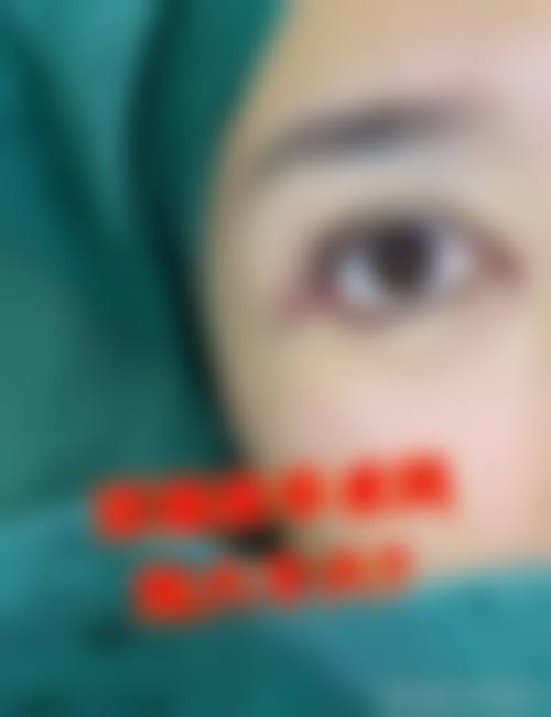 东莞维多利亚医疗美容整形医院怎么样价格收费