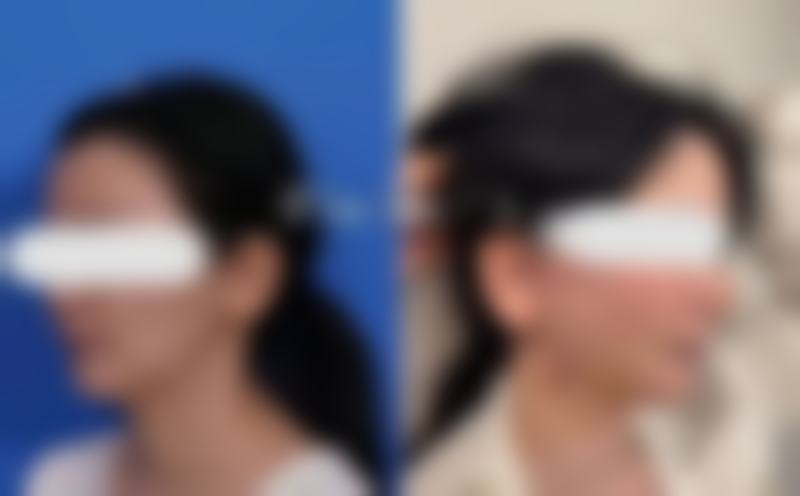 东莞维多利亚医疗美容整形医院怎么样特色项目及技术优势