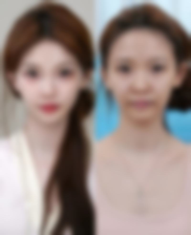 沈阳木奈医疗美容诊所怎么样价格收费