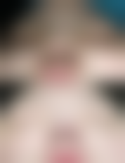 绍兴新昌艺素美整形医疗美容诊所怎么样特色项目及技术优势