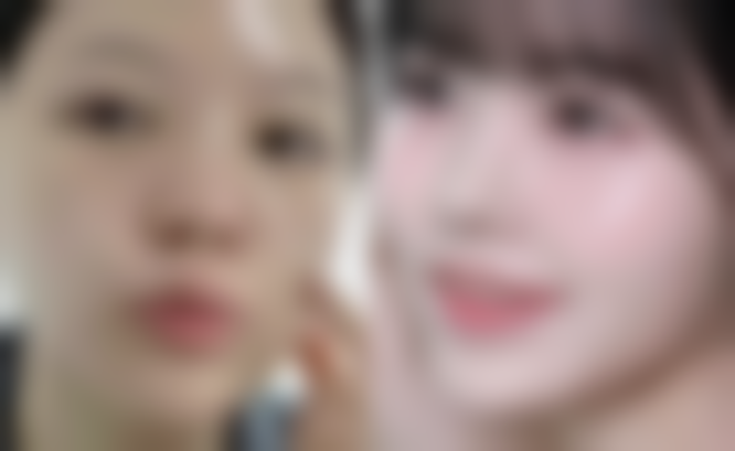 乌鲁木齐文艳医疗美容诊所怎么样求美者反馈