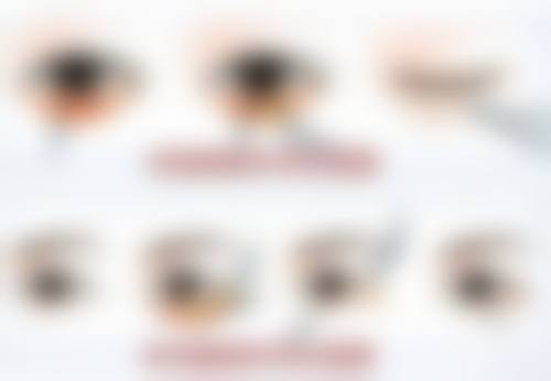 内蒙古兰玫医疗美容门诊部怎么样特色项目及技术优势