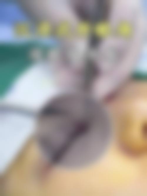 浙江省宁海县城关医院整形科怎么样来院路线