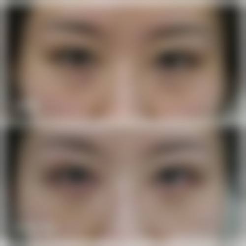 浙江省宁海县城关医院整形科怎么样特色项目及技术优势