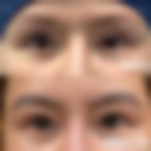 勐海县人民医院医疗美容门诊部怎么样医生团队实力