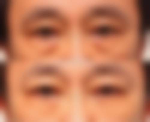 勐海县人民医院医疗美容门诊部怎么样价格收费