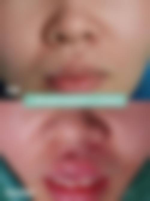 临沂协和医院整形美容科怎么样价格收费