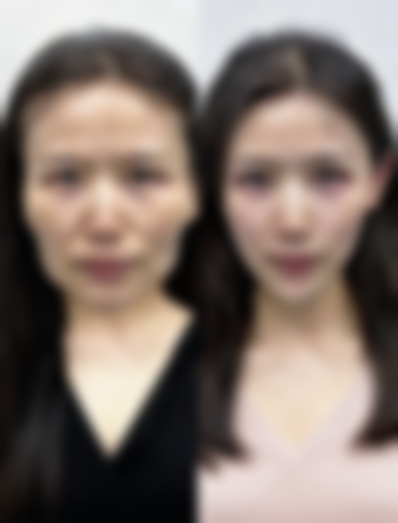 深圳清潭环球美天整形医院怎么样求美者反馈